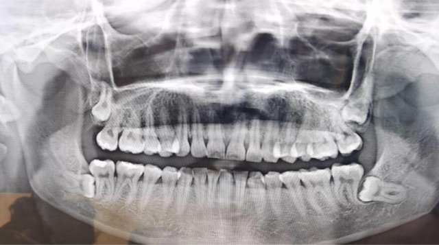 网络图片(侵删) 网络图片(侵删)