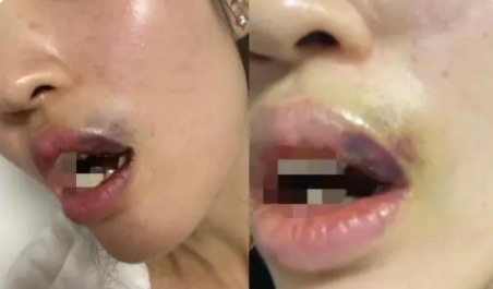 网络图片(侵删) 网络图片(侵删)