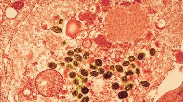 网络配图 网络配图